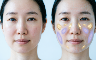 Skin test AI e fotoinvecchiamento