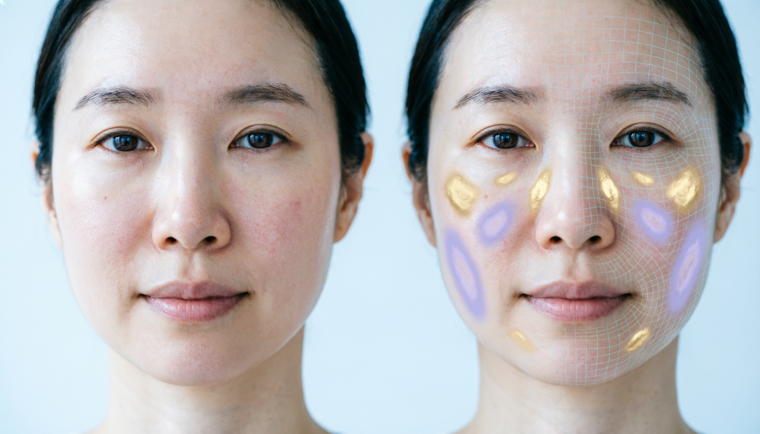 Skin test AI e fotoinvecchiamento Skin test AI e fotoinvecchiamento